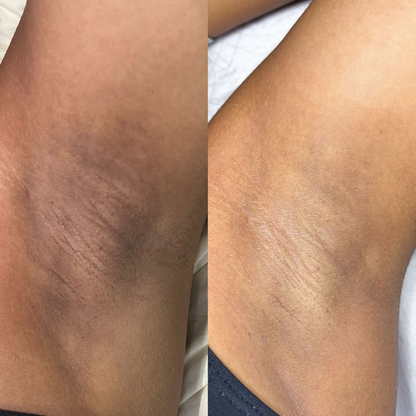 Exfoliante Corporal Aclarante