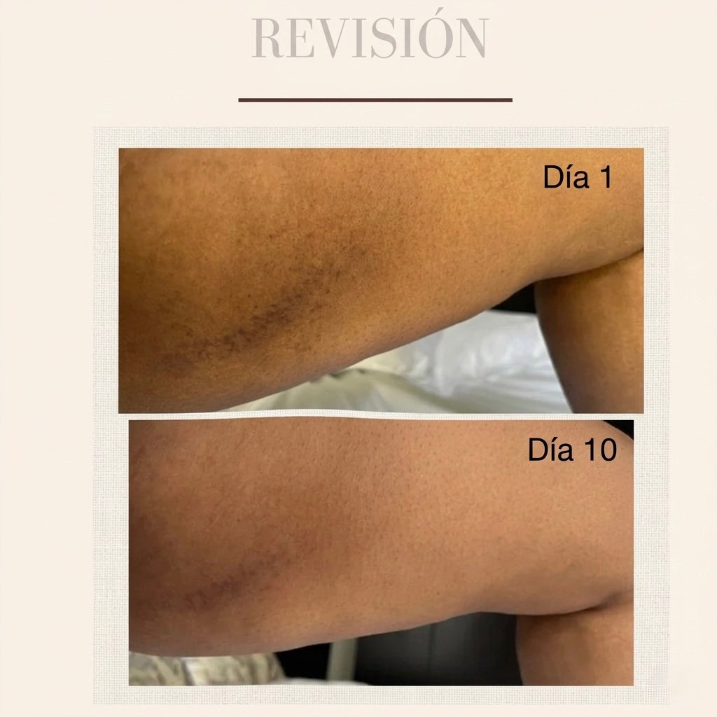 Exfoliante Corporal Aclarante