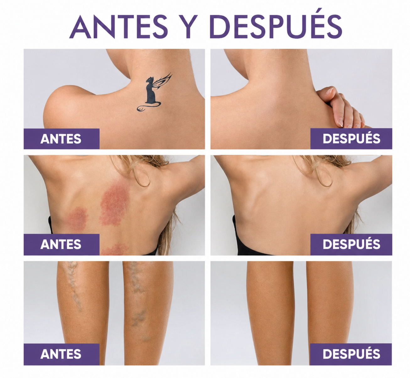 Perfeccionador corporal