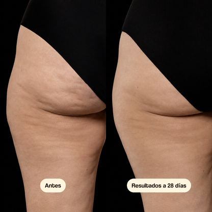 Aceite Anticelulitis Reafirmante Nutraplane