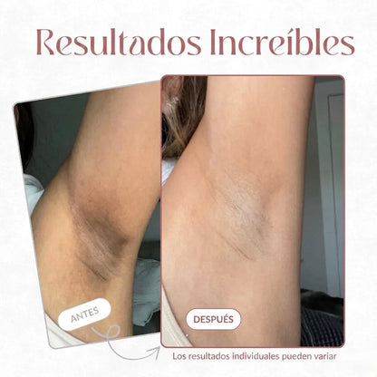 Exfoliante Corporal Aclarante