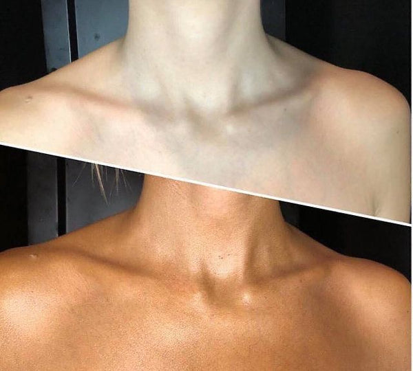 Bronceado